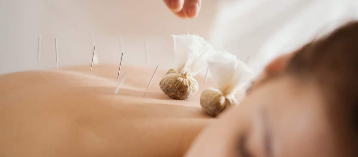 Young beautiful woman in spa receiving procedure of tibetan medicine, close up