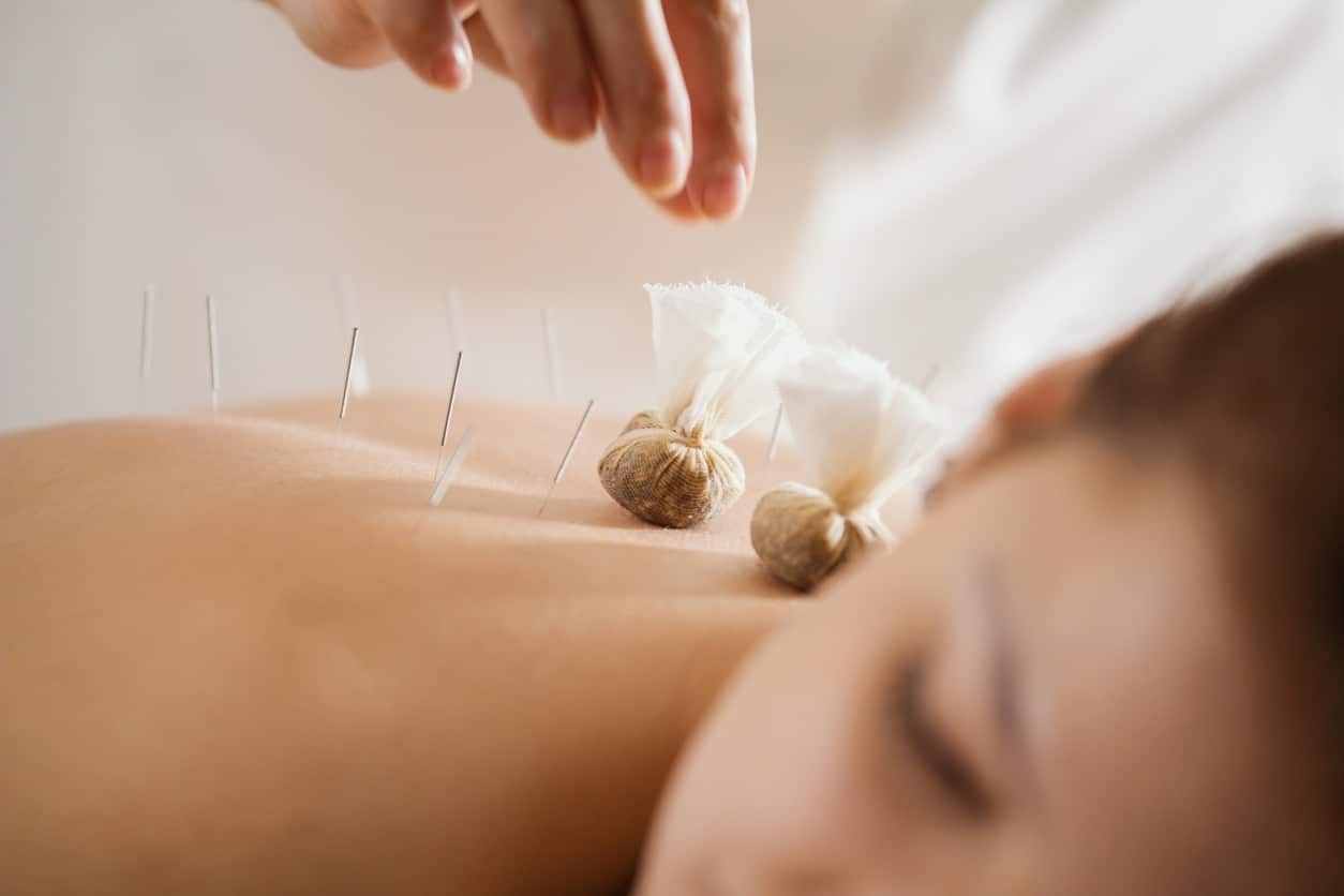 Young beautiful woman in spa receiving procedure of tibetan medicine, close up